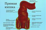 Международная политика.-vypadenie-pryamoj-kishki-u-detej.jpg